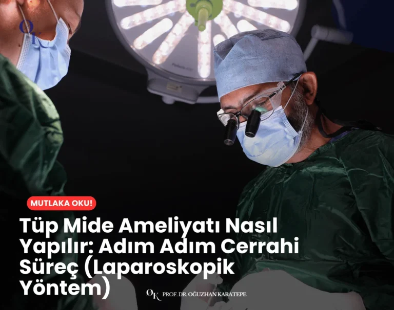 Tüp mide ameliyatı nasıl yapılır konusunu anlatan tıbbi çizim