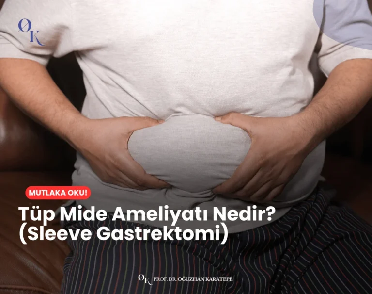 Tüp mide ameliyatı nedir sorusunun cevabını anlatan görsel