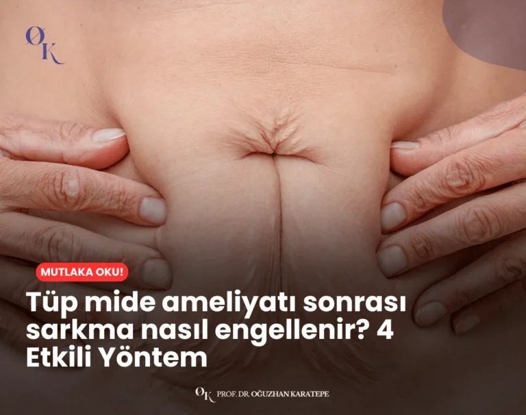 Tüp mide ameliyatı sonrası sarkma nasıl engellenir sorusunu açıklayan bilgilendirici grafik